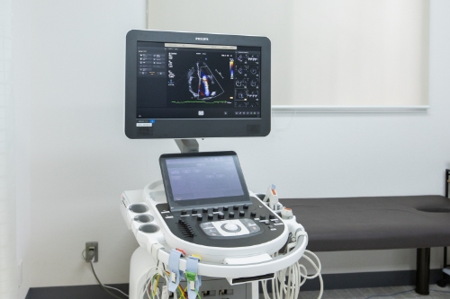 超音波画像診断装置（心臓血管用）